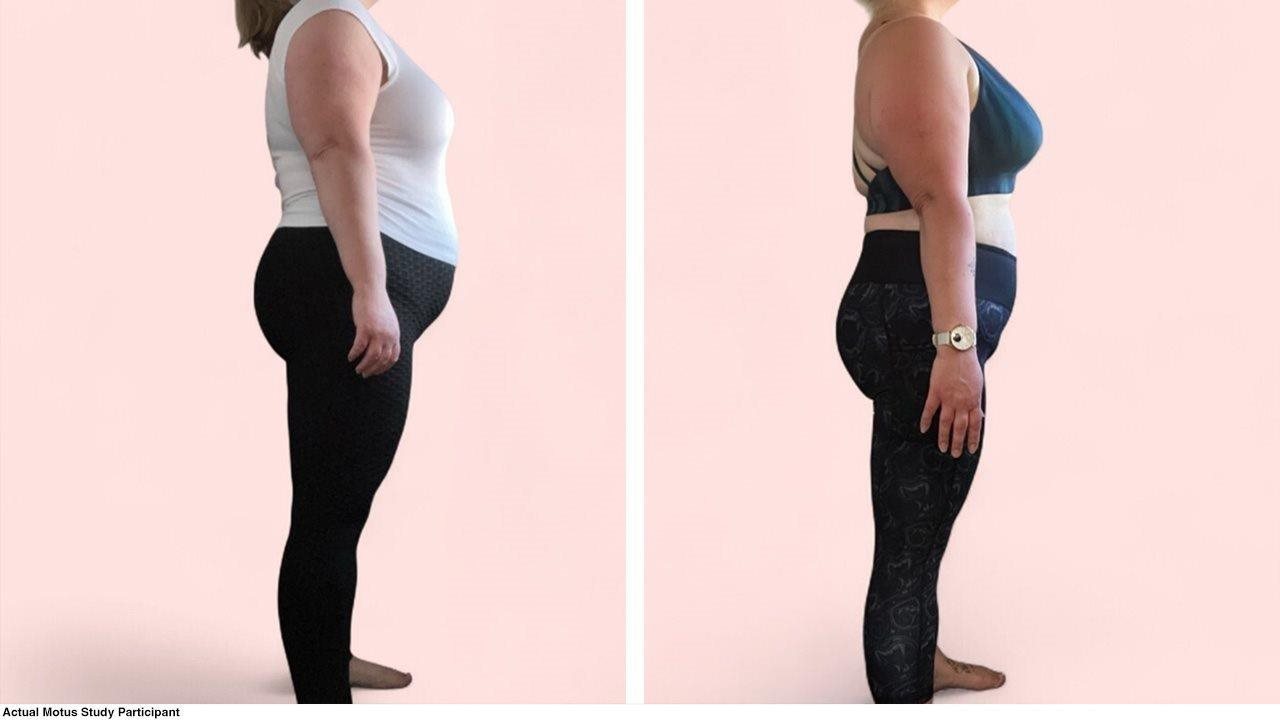 Shawna before and after using Motus for weight loss.