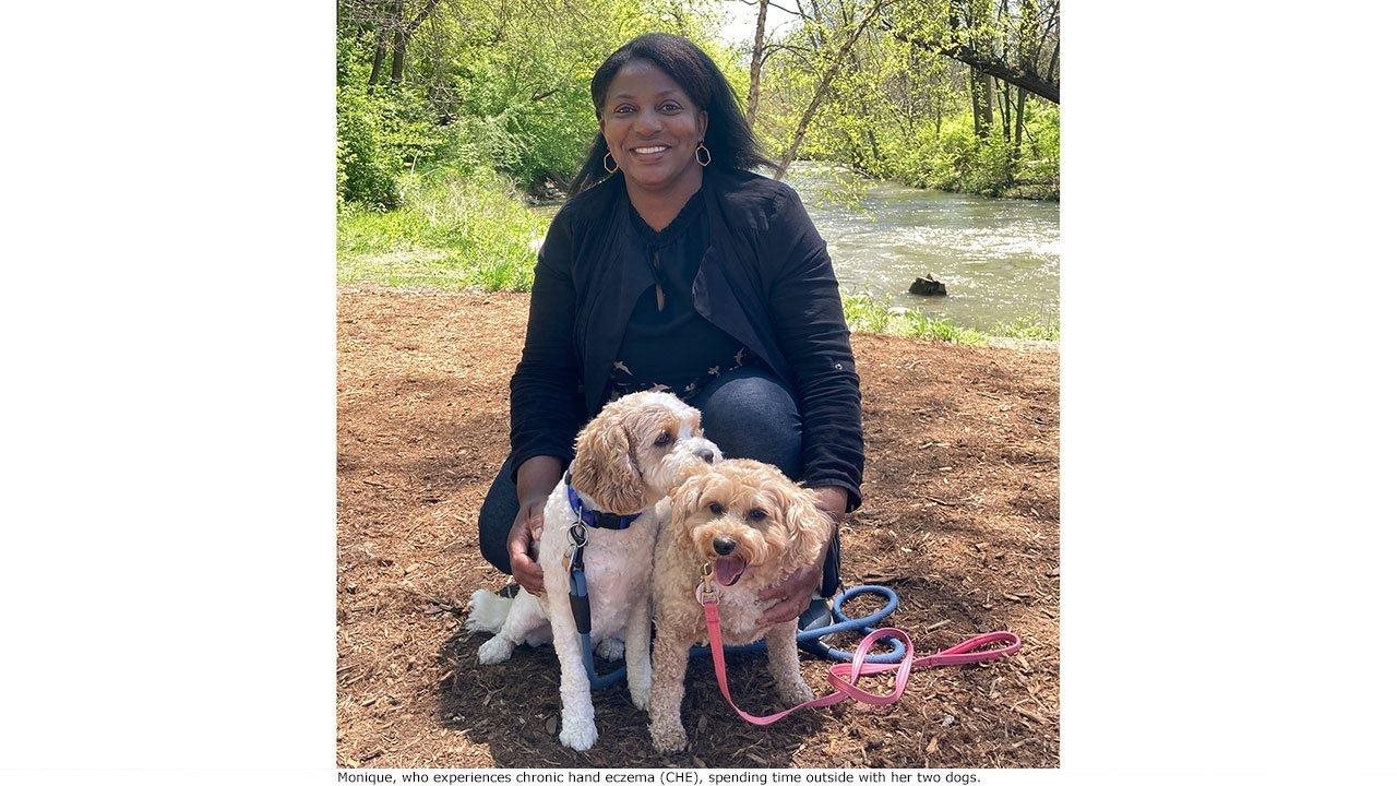 Monique pausing from a walk with her two dogs.