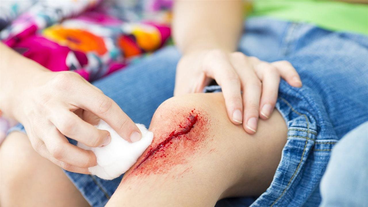 Pass on the peroxide : A surgeon guide to cleaning wounds at home
