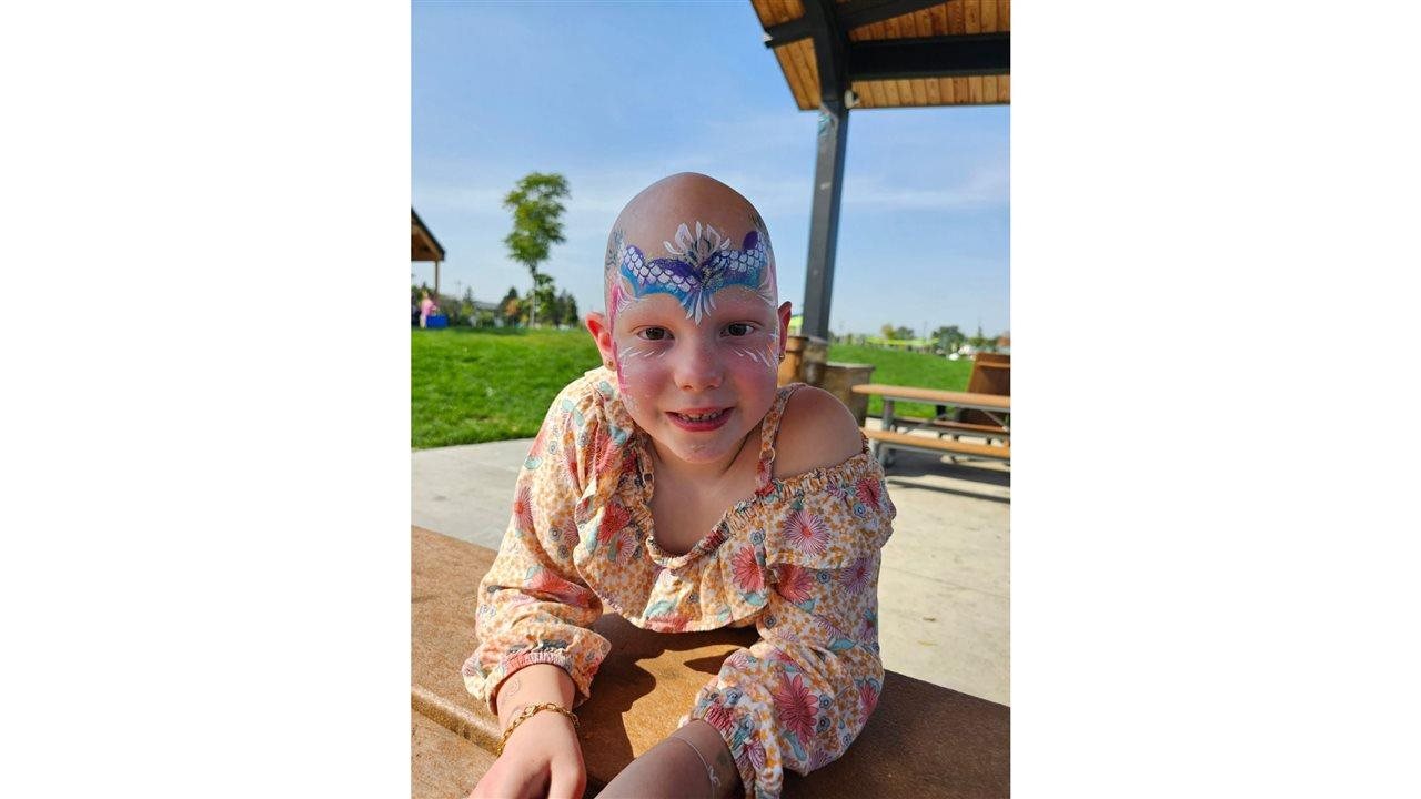 Photo for: Walk to build community for people with alopecia areata